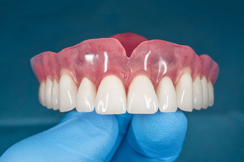 complete dentures