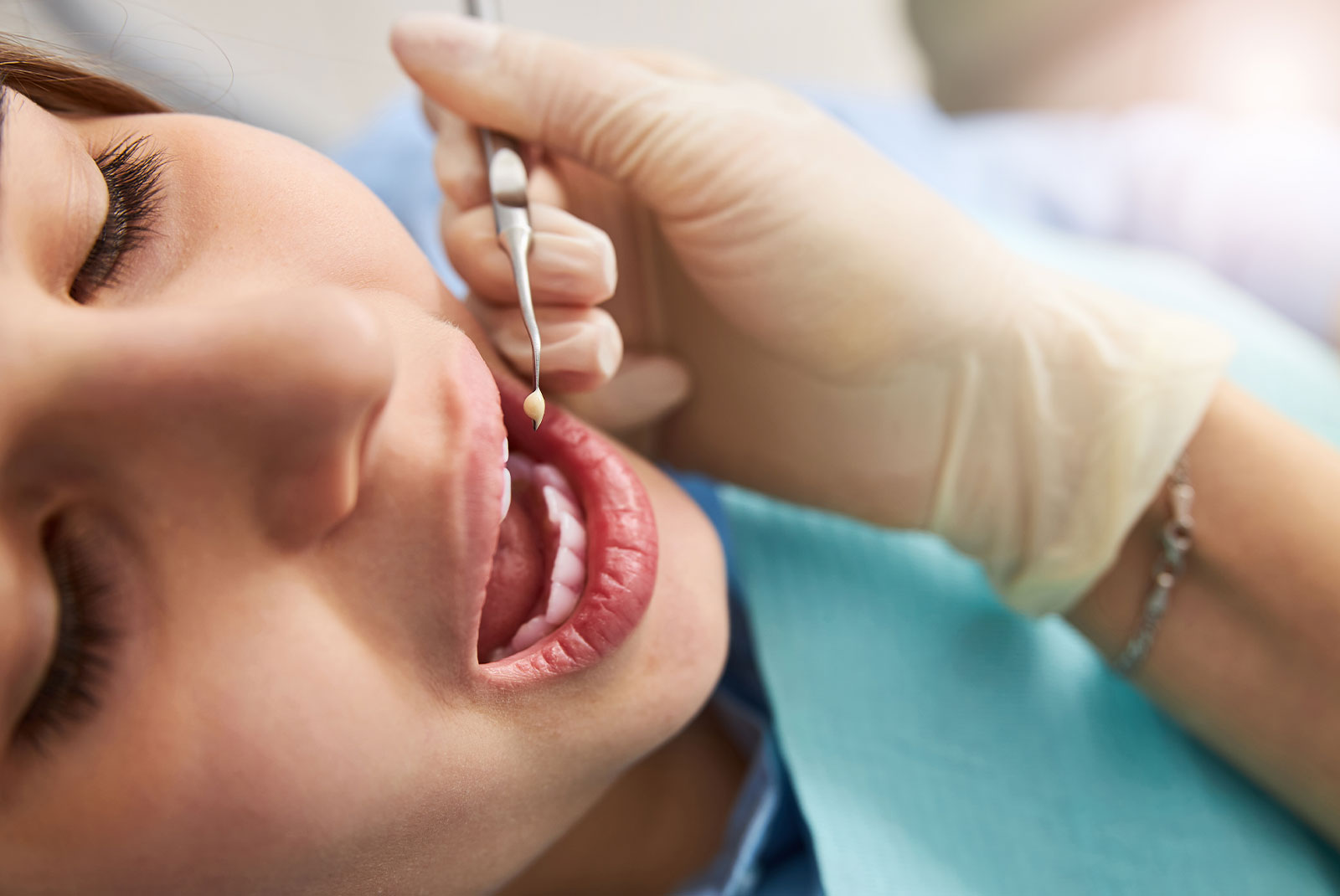 close up of child dental examination