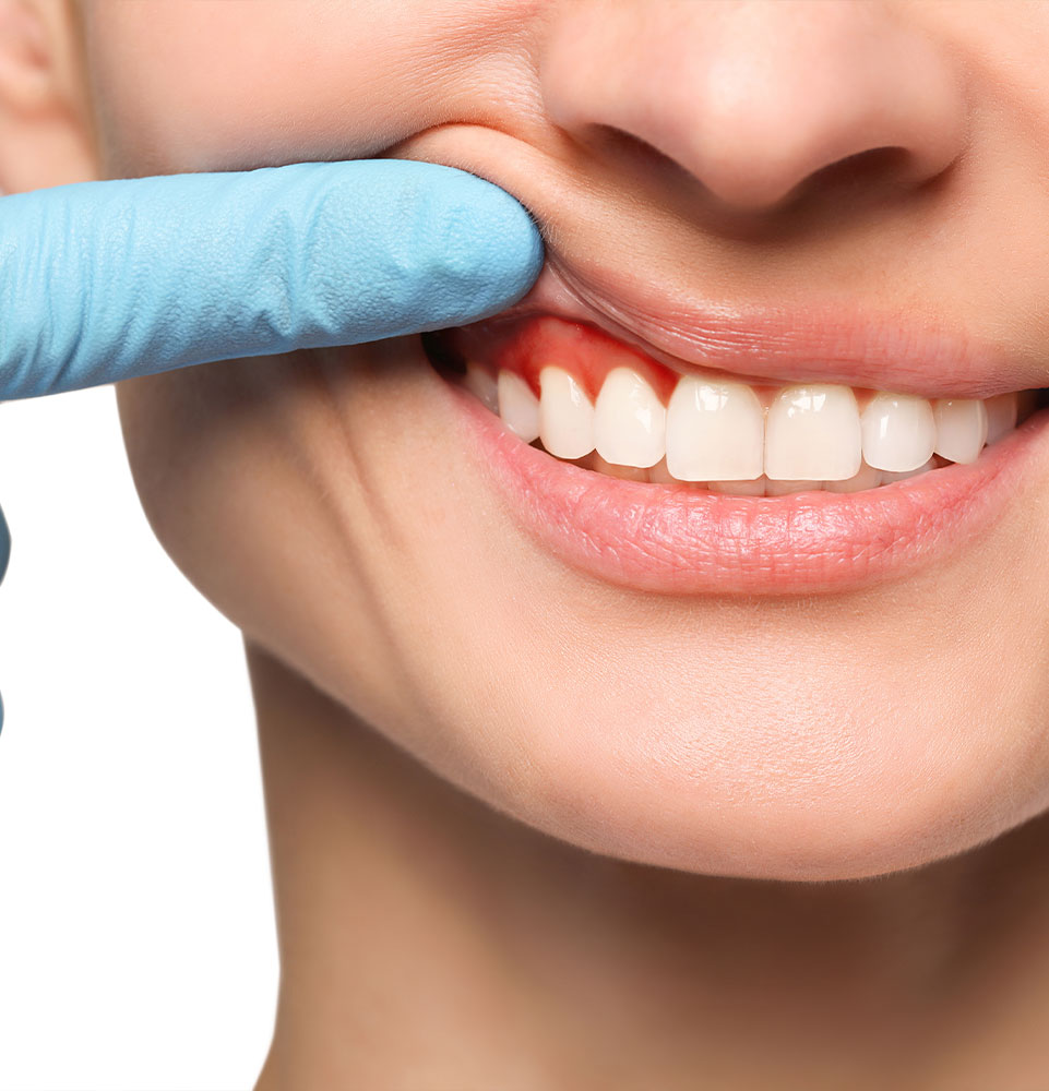Doctor examining woman's inflamed gum on white background