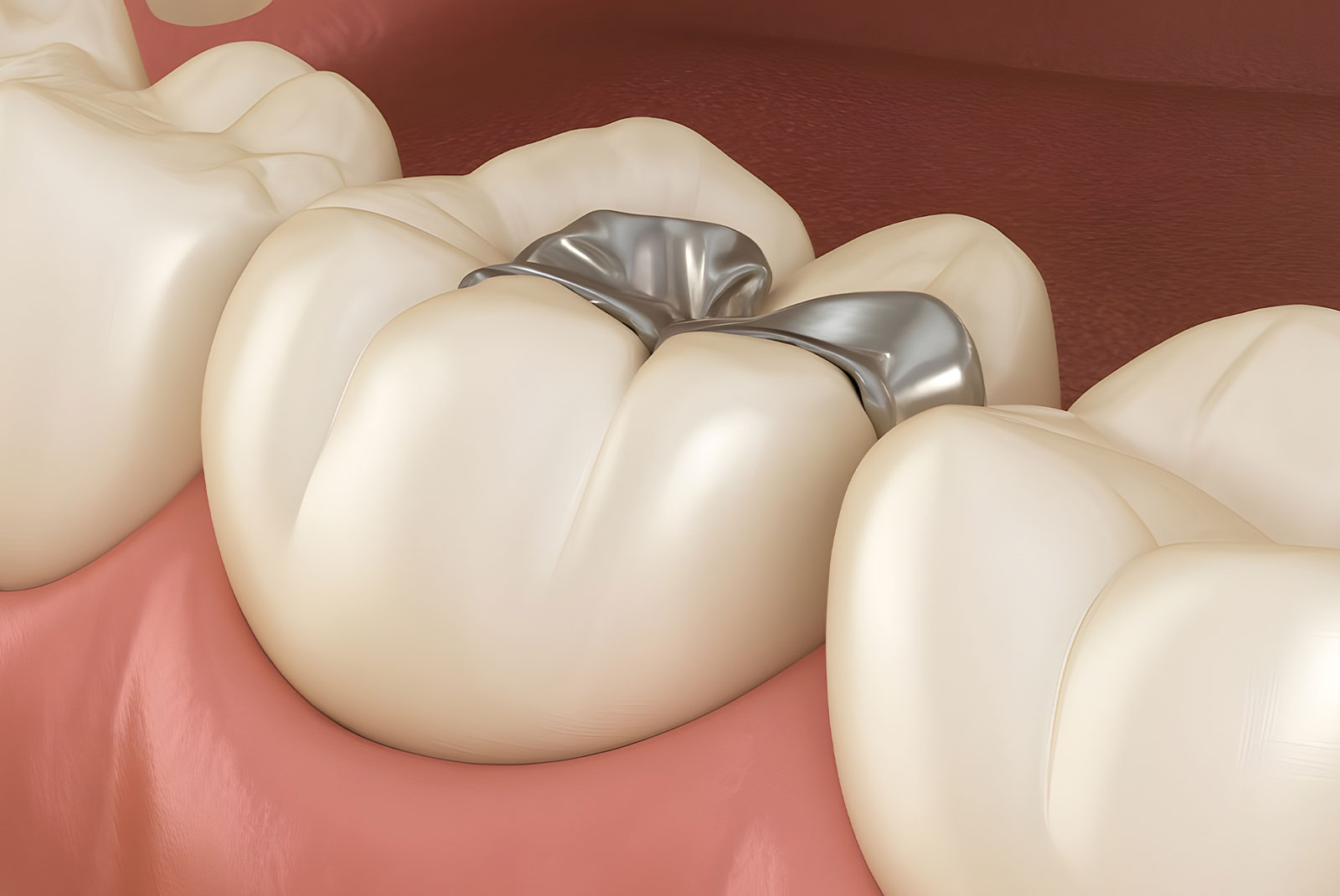 illustration of sealant