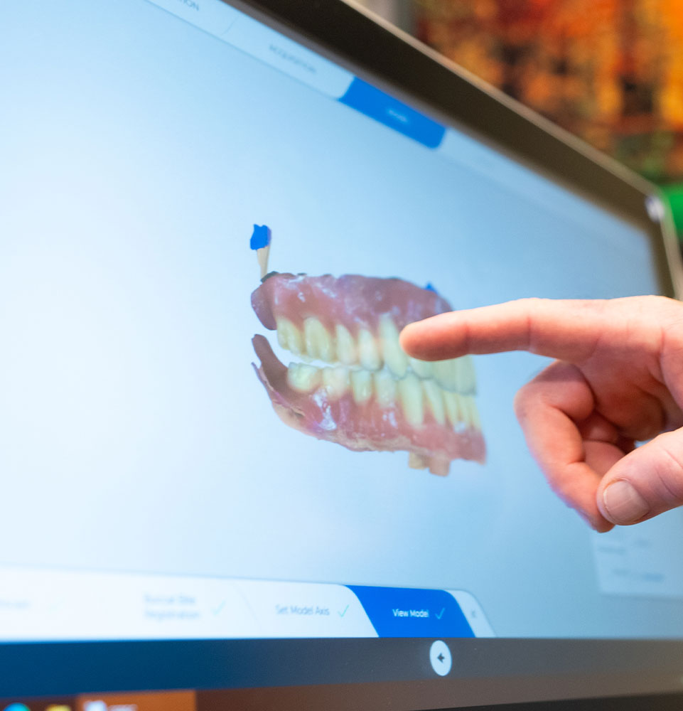 display of patient 3d scan mouth