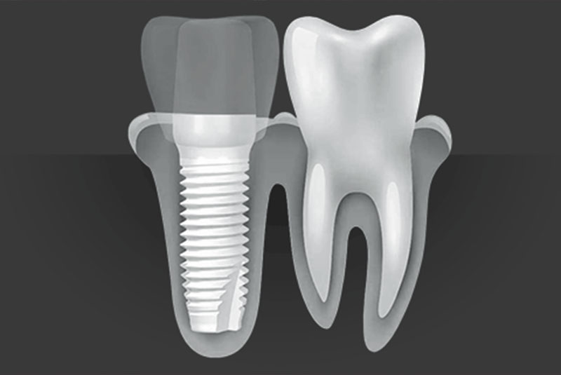 zirconia dental implant