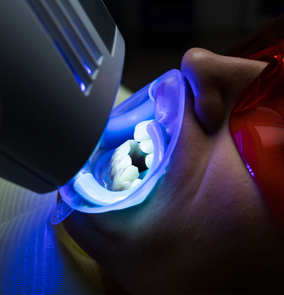 close up of patient having professional teeth whitening treatment