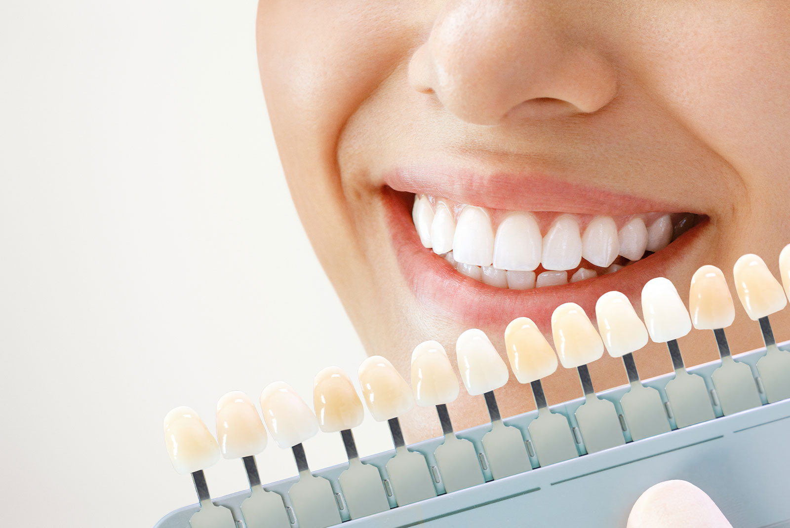 Smiling young woman. Cosmetological teeth whitening in a dental clinic
