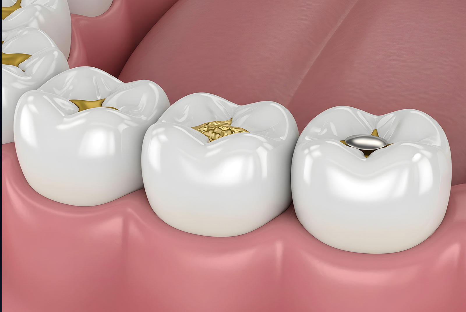 illustration of sealant
