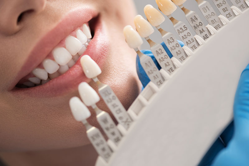 Dental crown situating near female mouth
