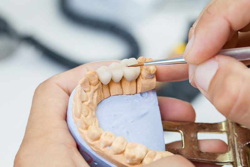 close of doctor working on dental crown